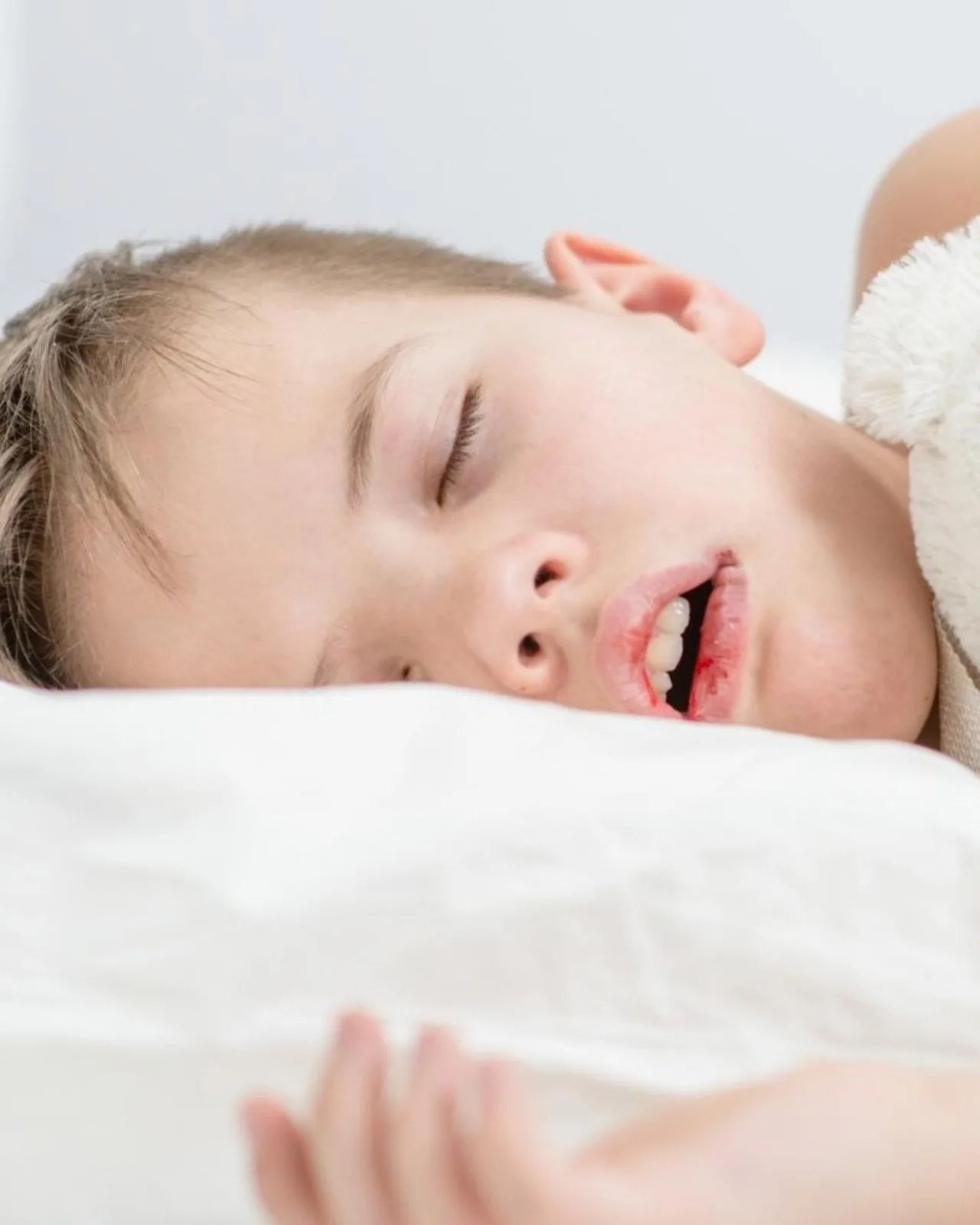Respiration buccale chez l'enfant : signe à surveiller